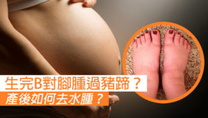 產後如何去水腫？