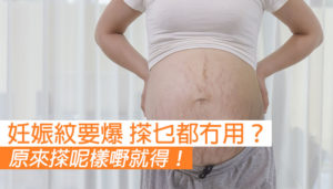 擊退妊娠紋！唔係冇可能！預防及減淡妊娠紋方法