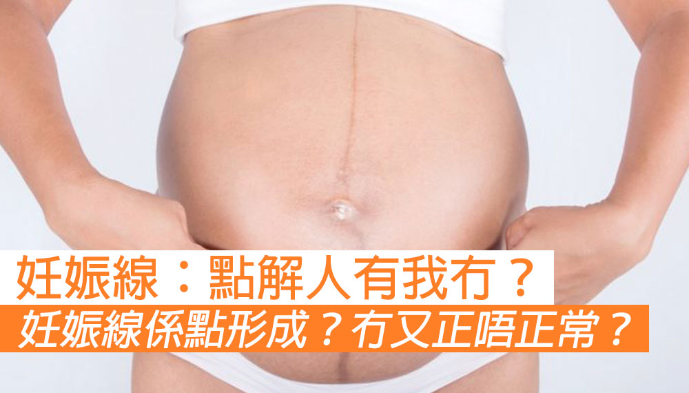 妊娠線：點解人有我冇？